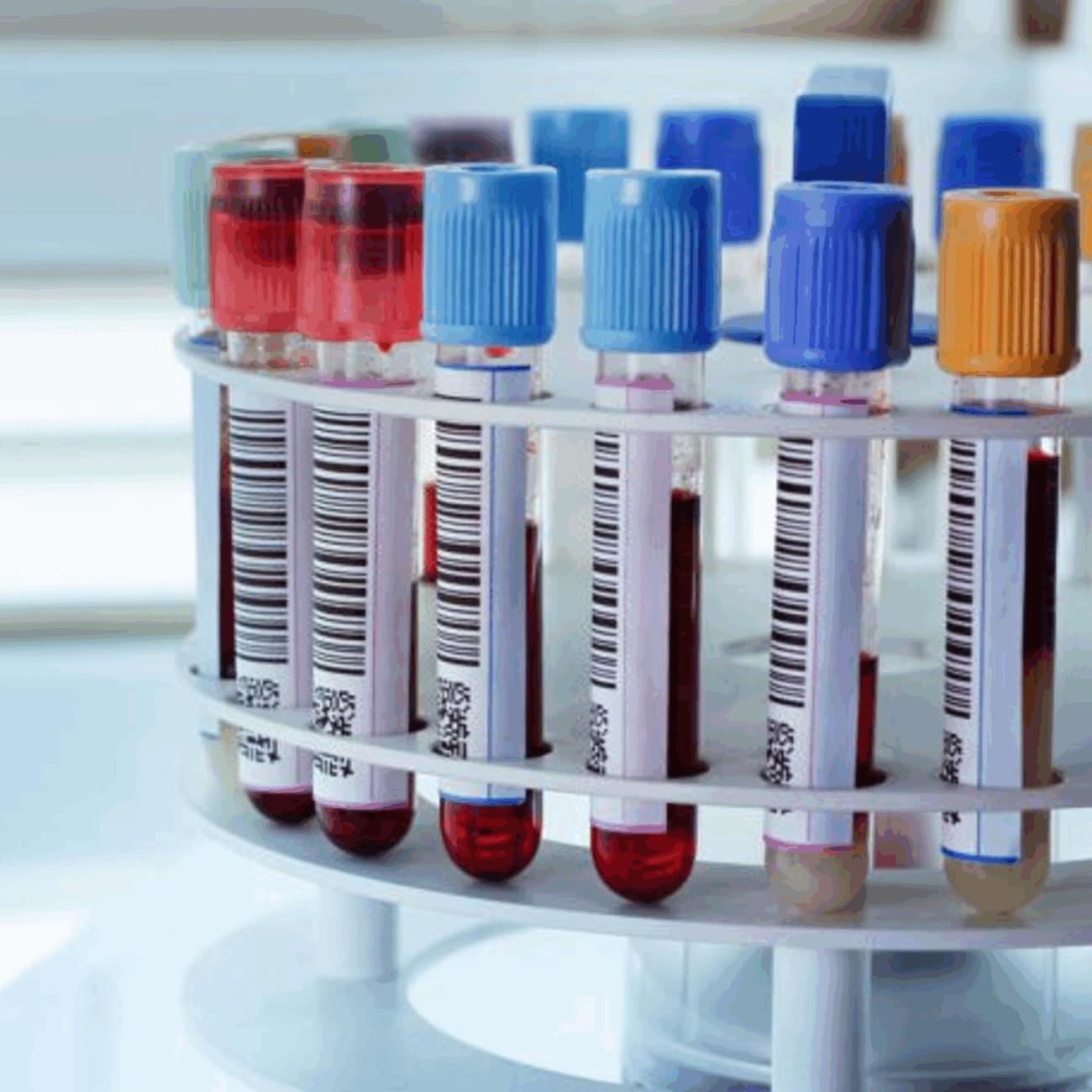 Le ruban résine DNP R380 résistant à l'alcool offre les meilleurs résultats d'impression sur les étiquettes synthétiques, par exemple dans les laboratoires ou les applications médicales